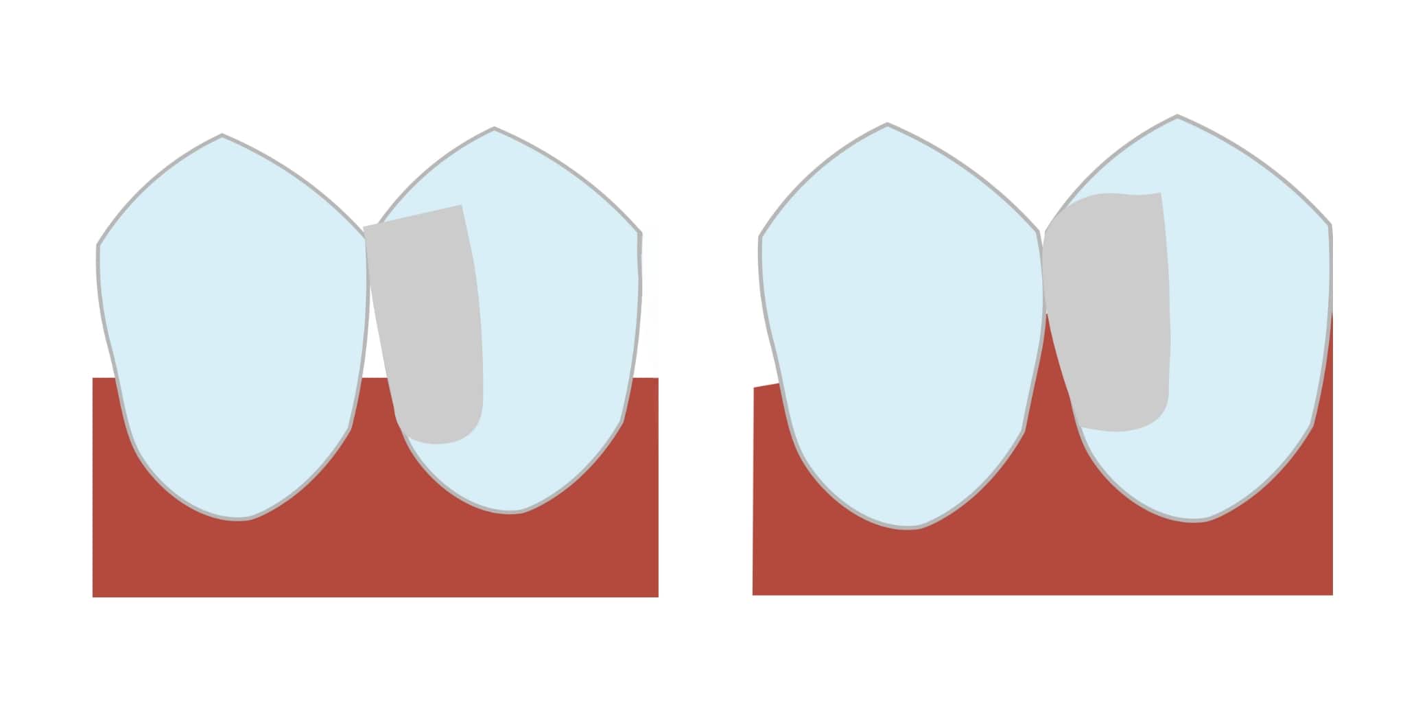 Miera konvexity matrice 2